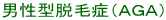 男性型脱毛症（ＡＧＡ） 
